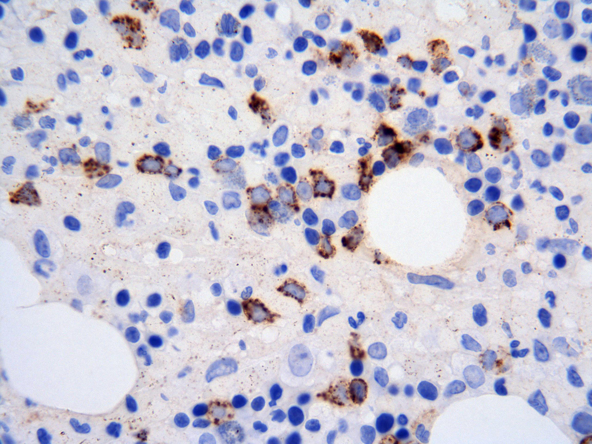 CD34 stain